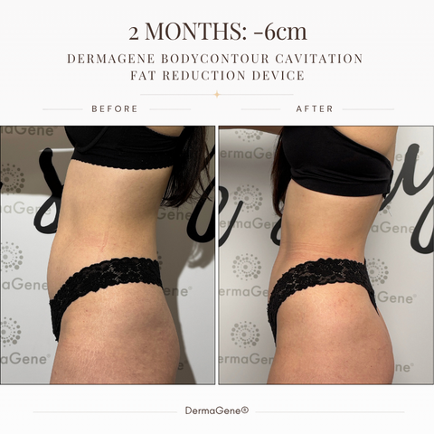 Total Body Sculpt & Smooth Ritual