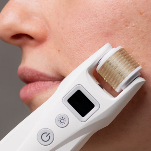 Microluxe 4in1 Dermaroller with Microcurrent and LED Therapy