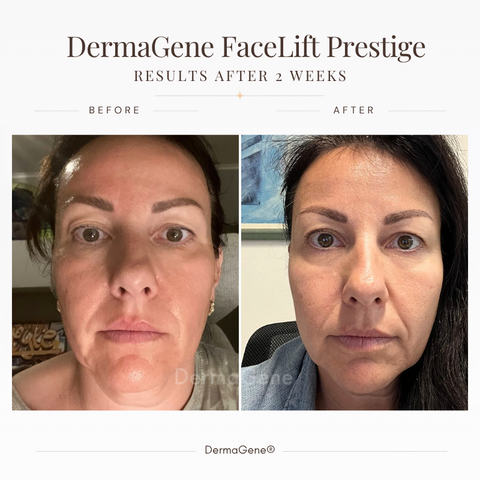 PRESTIGE Ultimate Face Sculpt Ritual