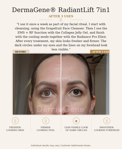 DermaGene® RadiantLift 7in1 with RF, EMS and 7 Technologies- The Face Architecture Device